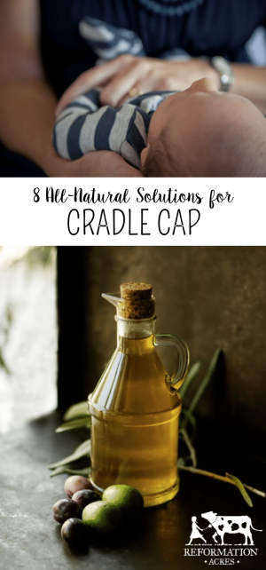 Here is an easy, effective, and cheap all-natural cradle cap treatment that worked well for my babies.